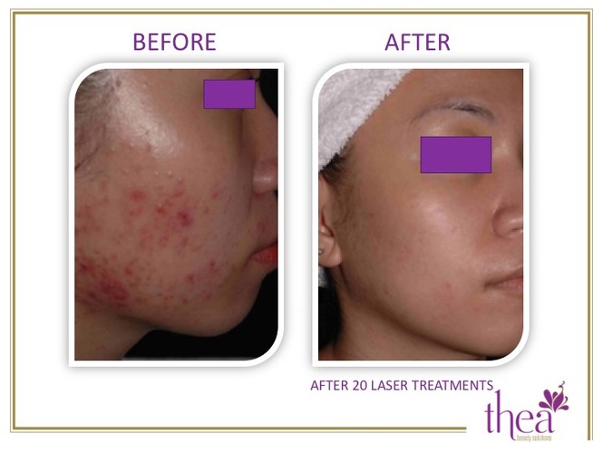 Thea Beauty Solutions ra mắt gói chăm sóc da siêu ưu đãi - ảnh 3