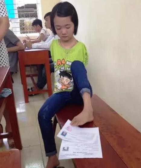 Thí sinh làm bài bằng chân được đặc cách vào thẳng đại học - ảnh 2