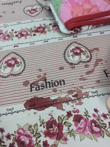 Mẹ hốt hoảng thấy con bị chuột cắn nát tay khi đang ngủ - ảnh 1