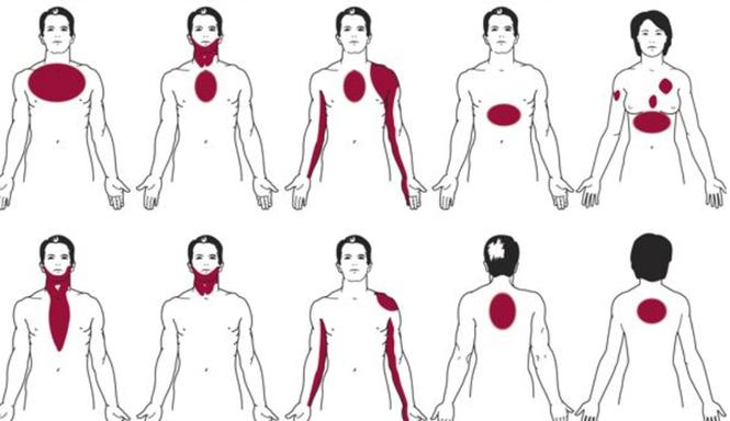Giải mã nguyên nhân bị bệnh ở chỗ này lại đau ở chỗ khác - ảnh 1