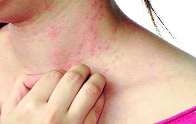 Tác dụng bất ngờ của cúc họa mi với sức khỏe - ảnh 5