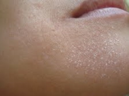 Tác dụng bất ngờ của cúc họa mi với sức khỏe - ảnh 6