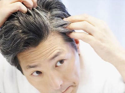 Nhìn vị trí tóc bạc sớm đoán nhiều bệnh nan y - ảnh 2