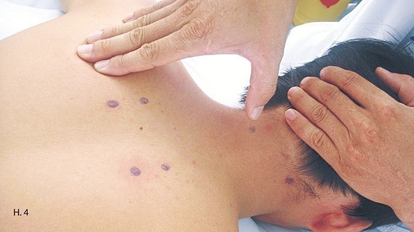 Xoa bóp chữa đau vai gáy hiệu quả - ảnh 4