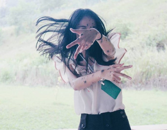 Cô gái có hàng trăm nốt ruồi bất ngờ thi Hoa hậu Hoàn vũ - ảnh 7