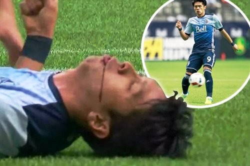 Tại sao va chạm khi tranh bóng có thể khiến cầu thủ thiệt mạng - ảnh 1