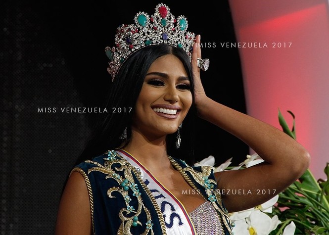 Với số đo 'vàng' 90 - 60 - 90, mỹ nhân này trở thành Hoa hậu Venezuela 2017 - ảnh 3