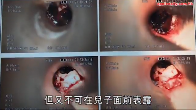 Bị bạn học bắt nạt nhét tẩy vào tai, bé trai sợ đến nỗi hoảng loạn đòi chết - ảnh 1