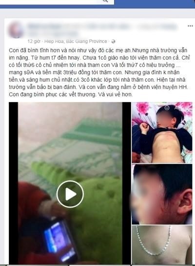 Cô giáo bị nghi đánh bé gái 4 tuổi bầm tím toàn thân - ảnh 1