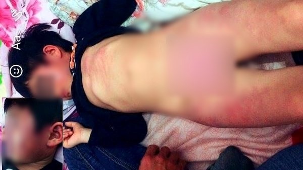 Cô giáo bị nghi đánh bé gái 4 tuổi bầm tím toàn thân - ảnh 2
