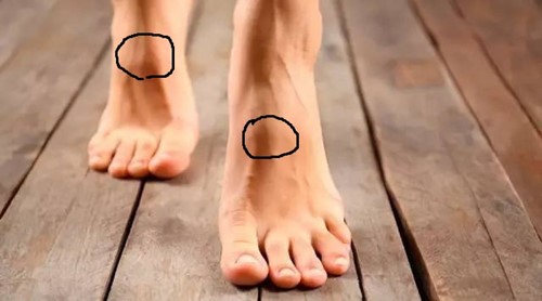 Mẹo đơn giản tự kiểm tra có huyết khối nguy hiểm hay không - ảnh 1
