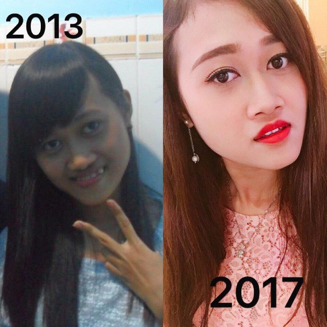 Loạt ảnh bạn trẻ 'dậy thì thành công' tiếp tục gây bão mạng - ảnh 4