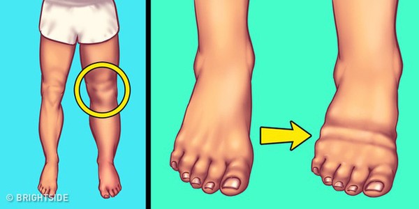 6 vấn đề cơ thể gặp phải khi bạn ăn quá nhiều muối - ảnh 5