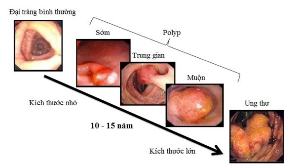 Ung thư đường tiêu hóa, họa từ miệng - ảnh 2 Ung thư đường tiêu hóa, họa từ miệng - ảnh 2