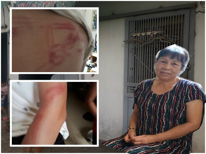 Vụ bố dùng tuýp sắt đánh con 'như kẻ thù': Người mẹ lên tiếng - ảnh 1