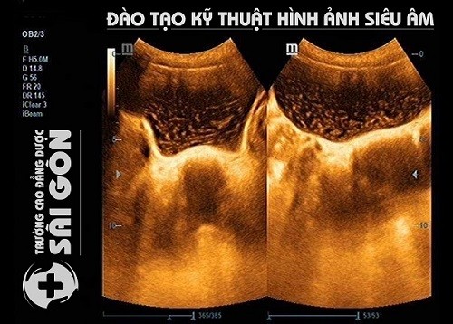 Học Cao đẳng Kỹ thuật hình ảnh Y học thành phố Hồ Chí Minh ở đâu? - ảnh 1