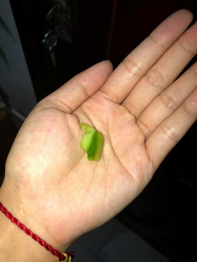 Bé gái 15 tháng suýt chết vì miếng dưa chuột bố đưa - ảnh 1