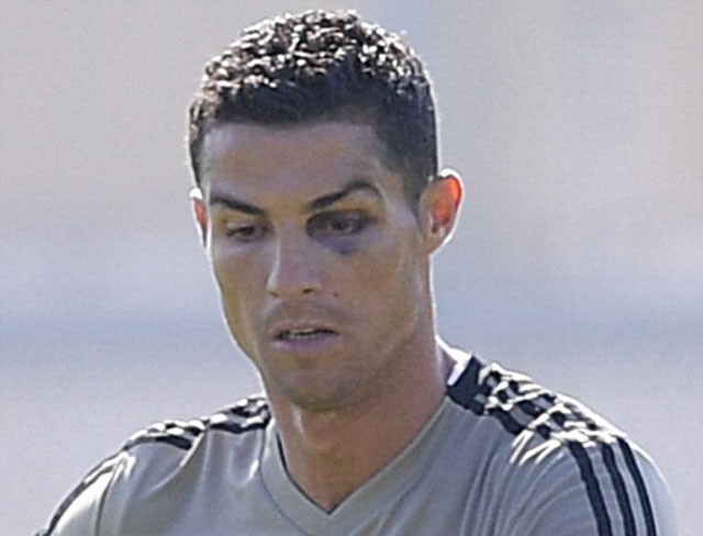 Vì Juventus, Ronaldo sẵn sàng ‘gạt bỏ’ chấn thương và ĐTQG - ảnh 1