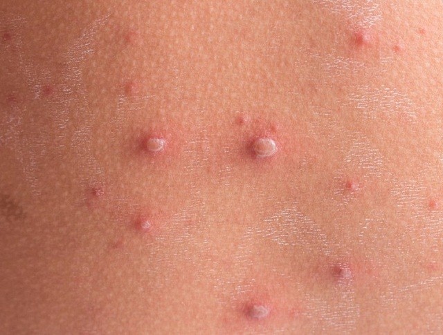 Trường hợp hy hữu, bé sơ sinh bị nhiễm HIV từ cha đẻ? - ảnh 2