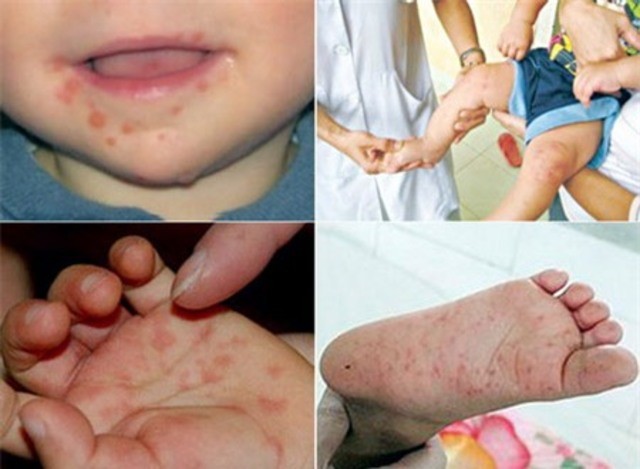Những hiểm hoạ khôn lường với trẻ từ… nhà vệ sinh bẩn - ảnh 1