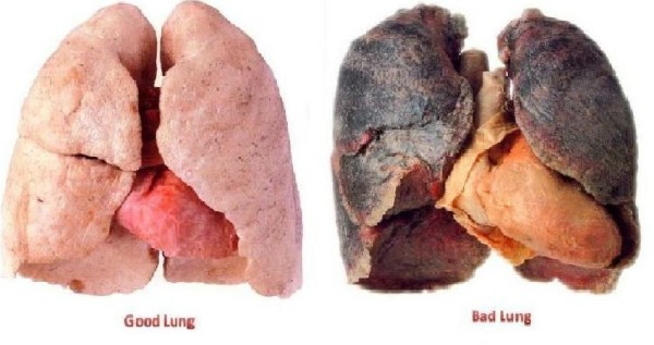 10 dấu hiệu cảnh báo ung thư sớm không thể làm ngơ - ảnh 1