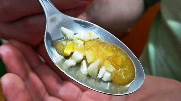 Nếu dùng quá nhiều thuốc giảm đau, sức khỏe bạn chắc chắn bị ảnh hưởng. (Ảnh: Hefty)