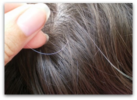 Nhìn vị trí tóc bạc sớm đoán nhiều bệnh nan y - ảnh 4