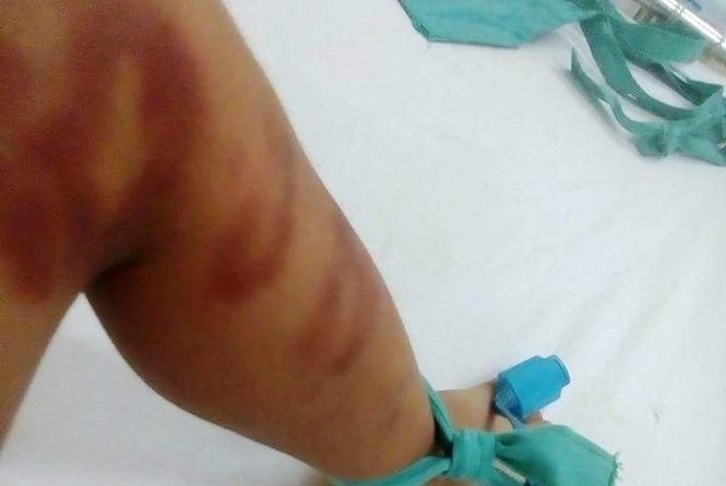 Bắt giữ đối tượng bạo hành dã man con riêng của bạn gái - ảnh 1