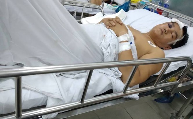Nam công nhân bị đánh nứt sọ não vì mâu thuẩn trong lúc làm - ảnh 1
