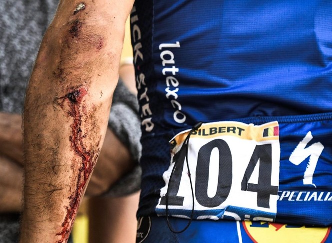 Cua-rơ rơi xuống vực, vẫn cố về đích ở Tour de France - ảnh 4