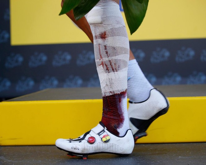 Cua-rơ rơi xuống vực, vẫn cố về đích ở Tour de France - ảnh 5