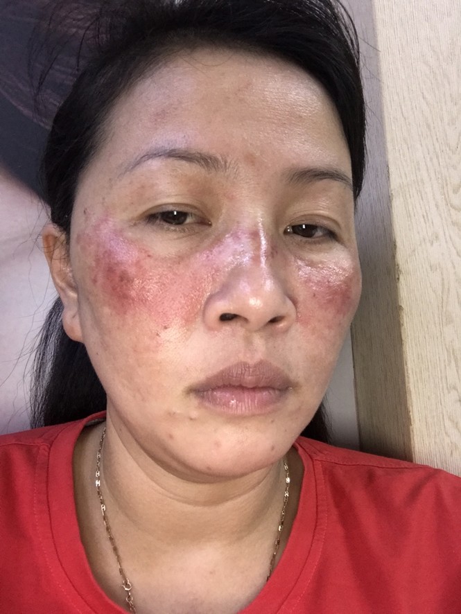 Bị đánh dã man sau khi gọi nhờ công an đến làm việc - ảnh 2