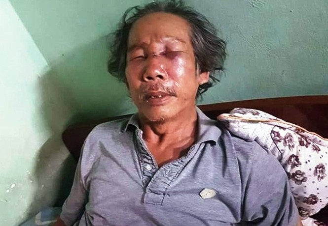 Bảo vệ chung cư đánh gục cụ ông 70 tuổi - ảnh 1
