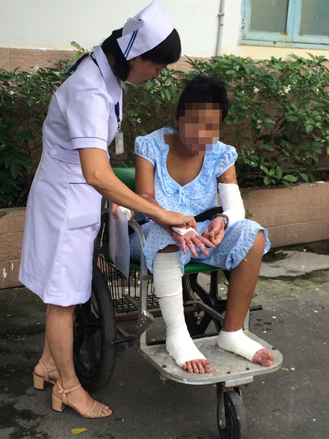 Em bé bán vé số bị mẹ thiêu sống đã xuất viện - ảnh 2