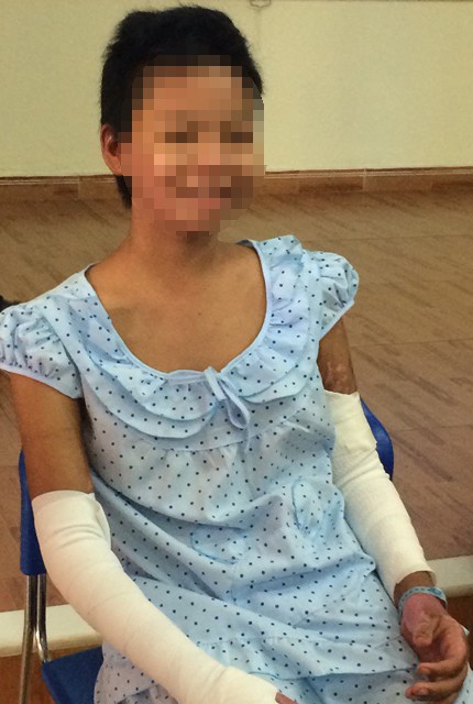 Em bé bán vé số bị mẹ thiêu sống đã xuất viện - ảnh 1