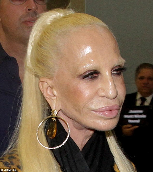 Nhà thiết kế Donatella Versace xấu xí sau thẩm mỹ - ảnh 1