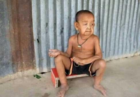 Xót xa hình ảnh 'cụ ông' 4 tuổi vì mắc bệnh lạ - ảnh 4