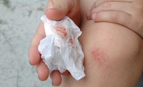 Vi rút HIV sống được bao lâu khi ở ngoài cơ thể? - ảnh 1