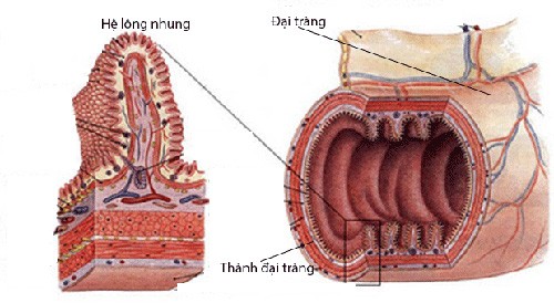 'Cứu cánh' cho người viêm đại tràng nhờ sáng chế của người Nhật - ảnh 1