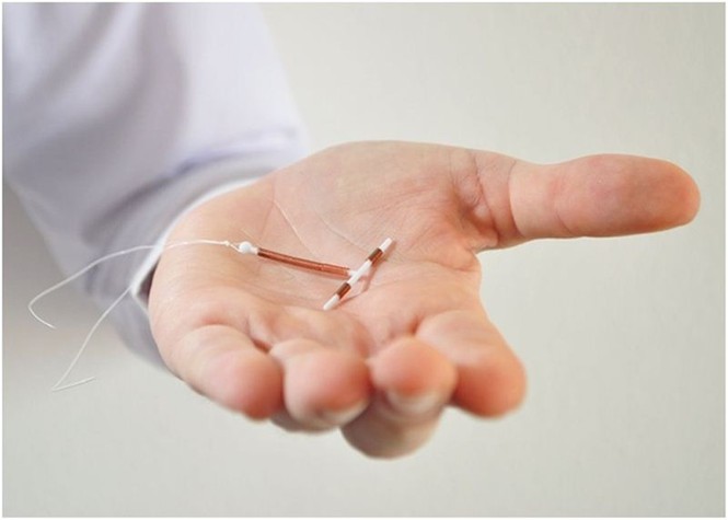 Chủ động thực hiện kế hoạch hóa gia đình với các biện pháp tránh thai - ảnh 1