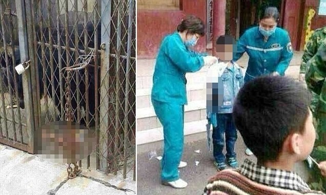 Cậu bé 9 tuổi bị gấu tấn công, cắn đứt tay trong vườn thú - ảnh 1