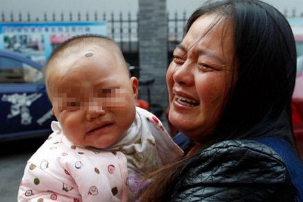 Hãi hùng phát hiện 12 chiếc kim trong người bé gái - ảnh 3