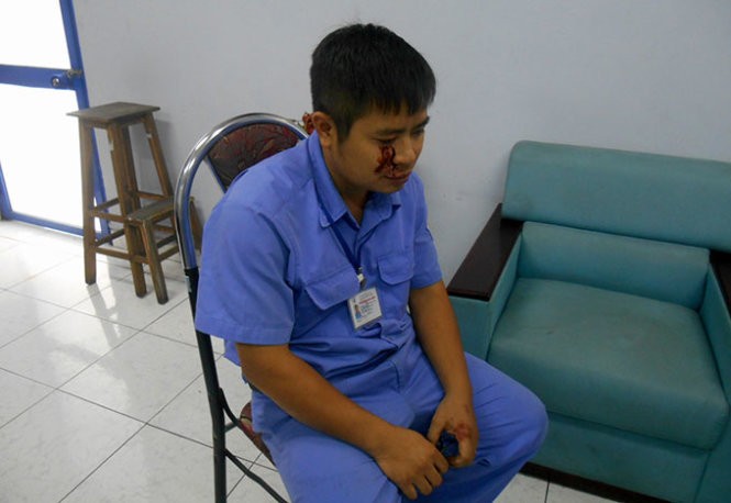 Không qua đăng kiểm, đấm rách mí mắt đăng kiểm viên - ảnh 1