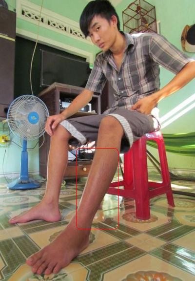 Rắn lục đuôi đỏ lại 'hoành hành' ở Quảng Ngãi - ảnh 1