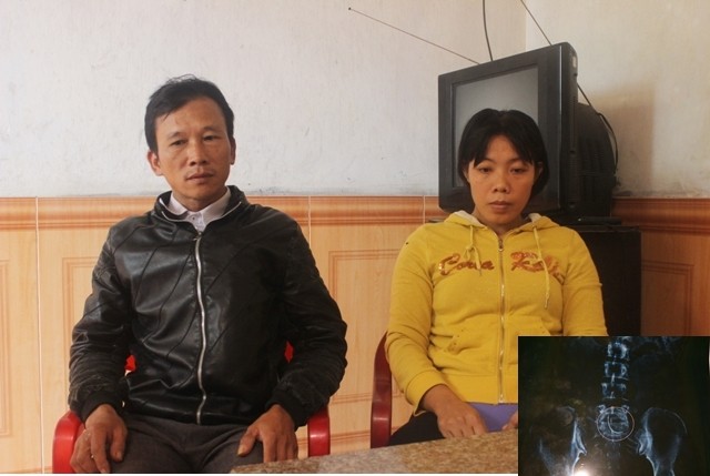 Giãi bày của bác sỹ để quên kim trong bụng bệnh nhân - ảnh 3
