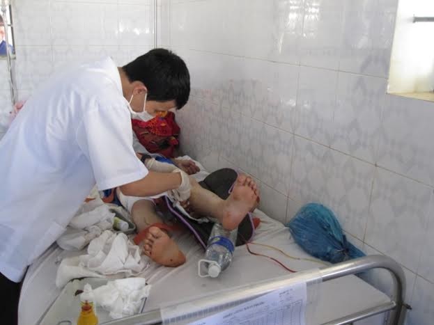 Heo rừng nặng hơn một tạ cắn nát chân người dân - ảnh 2