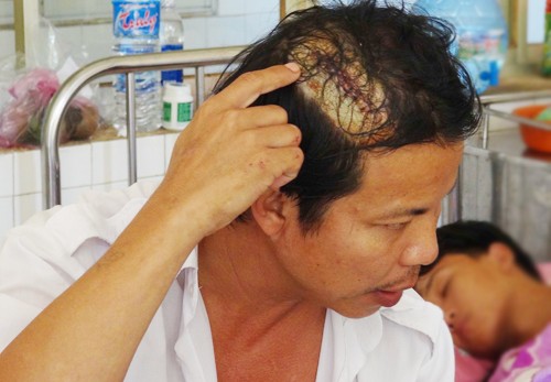 Thiếu nữ và người tình truy sát tài xế để cướp tài sản - ảnh 1