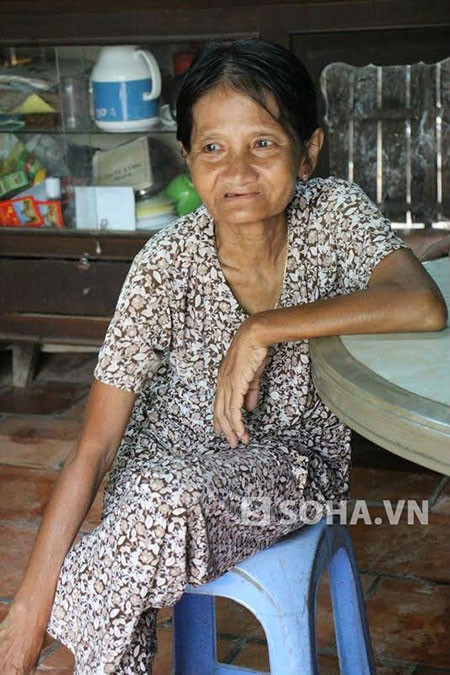 Thiếu nữ chết tức tưởi sau vài giờ tắm trắng - ảnh 1