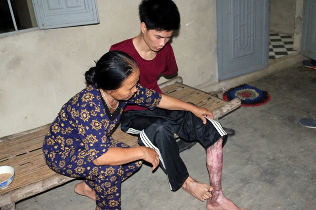 Cám cảnh cha mất hai tay chăm con thơ 14 tháng tuổi - ảnh 2