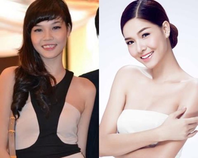 Sao Việt phẫu thuật thẩm mỹ - hành trình “lột xác” gian nan, ồn ào - ảnh 12